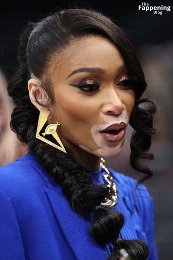 Winnie Harlow