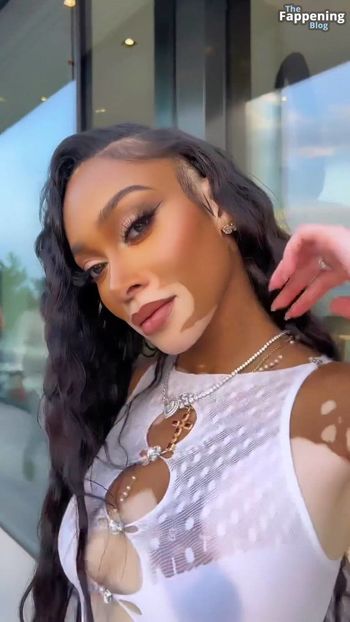 Winnie Harlow
