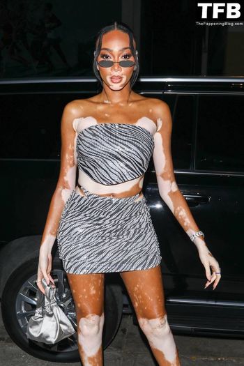 Winnie Harlow