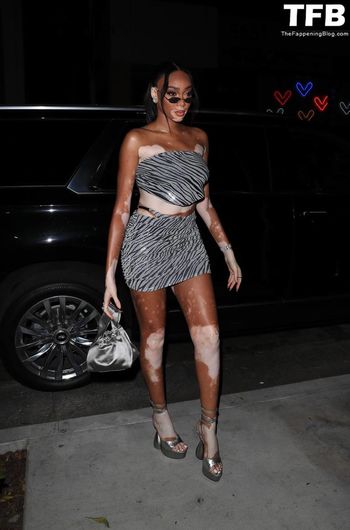 Winnie Harlow