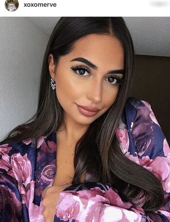Xoxomerve
